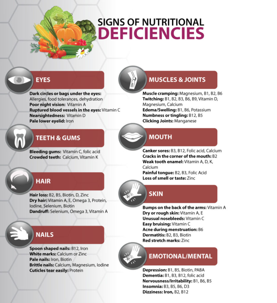 Signs of Nutritional deficiencies