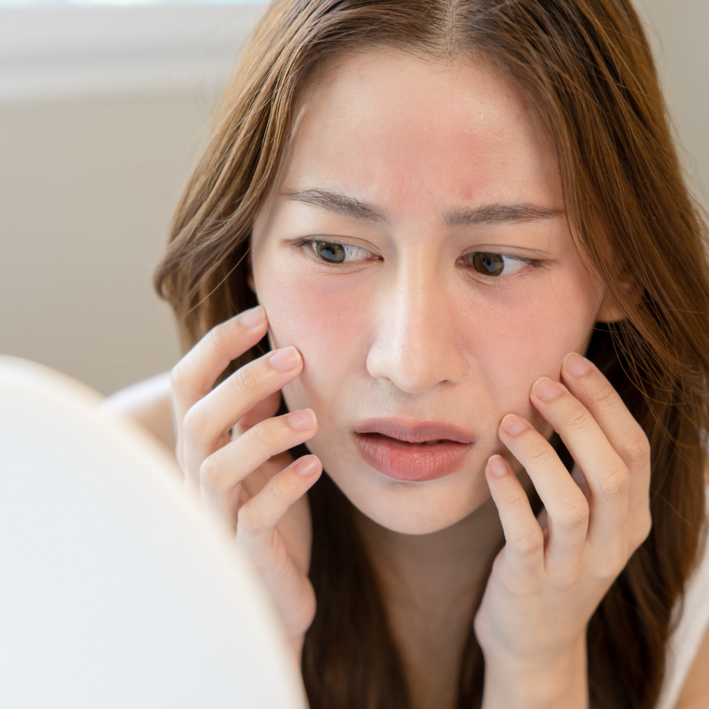 16 - Seaflora Skincare Why is retinol A making my skin red?