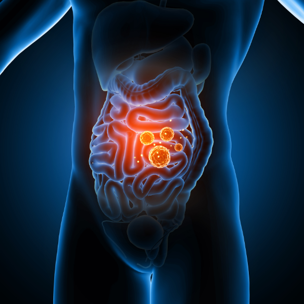 Inflammation of the gut - Seaflora Skincare prebiotic seaweed helps gut microbes