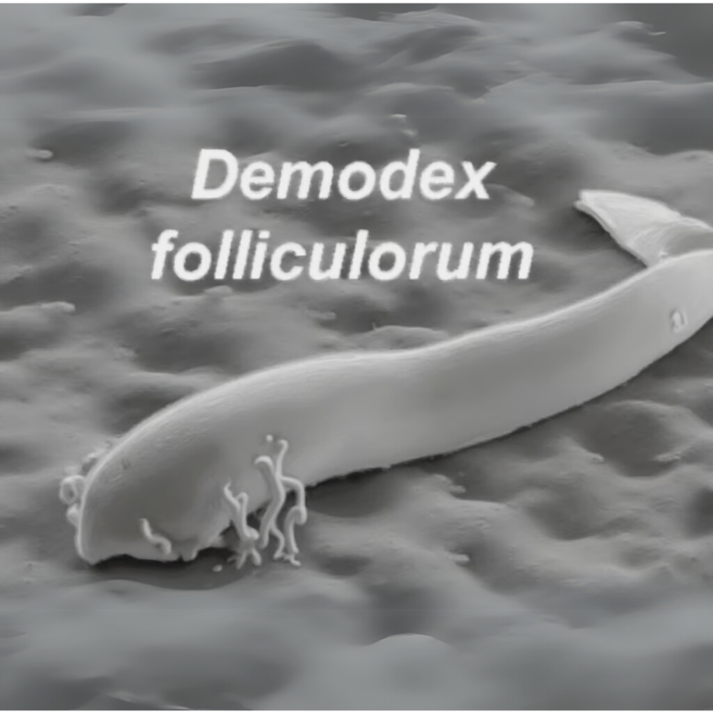 demodex - Seaflora Skincare Demodex on the skin