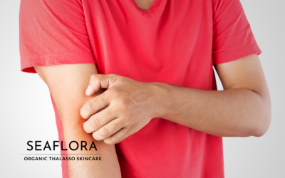 A woman in a red t-shirt scratches her arm until it is visibly red, symbolizing skin irritation from eczema and rosacea, with the Seaflora Skincare logo included.