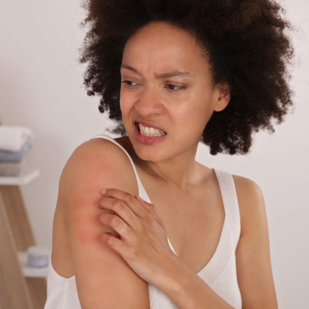 Why is my Retinol A cream making me itchy?