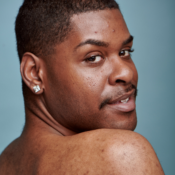 Inflammation and hyperpigmentation - Seaflora Skincare all inclusive skincare