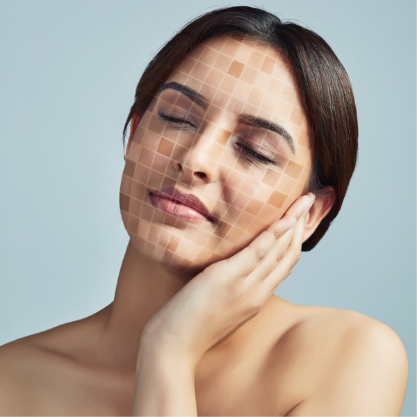 Uneven complexion - Seaflora Skincare The colour of skin