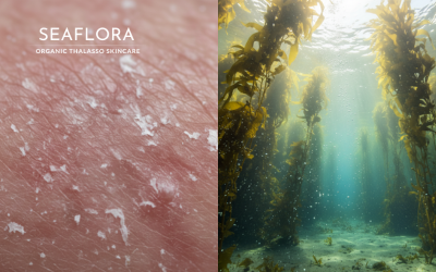 Seaflora logo on split image contrasting irritated skin (acid damage) with a lush kelp forest (algae healing) on the right side.